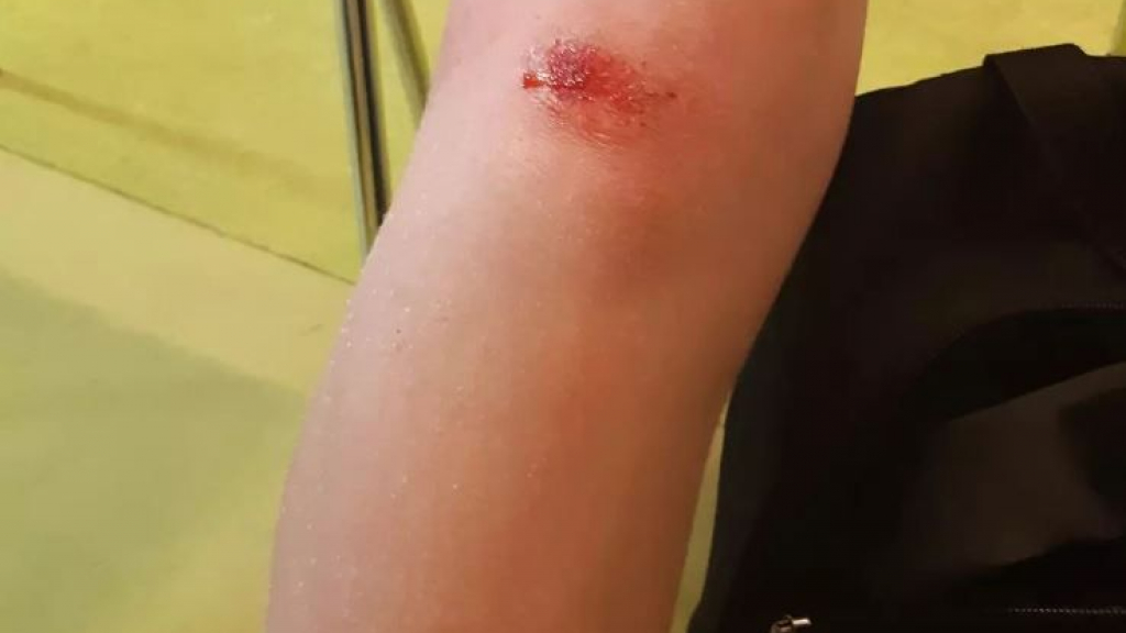 Foto: Getuigen gezocht