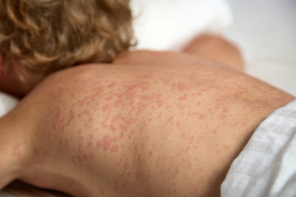 Foto: Voor of tegen vaccineren? Op de Biblebelt wordt het antwoord zorgvuldig verpakt