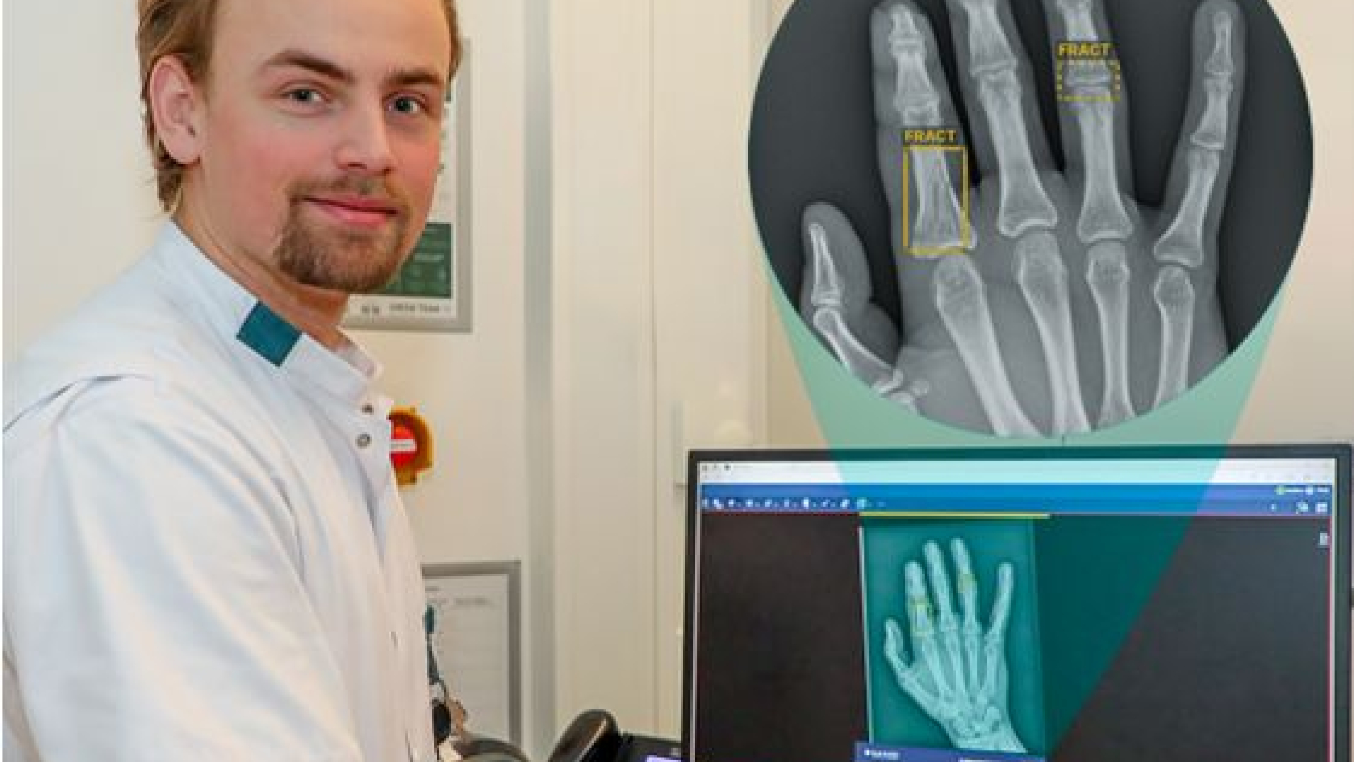 Foto: Sneller duidelijkheid over botbreuk voor patiënten op Huisartsenspoedpost Eemland