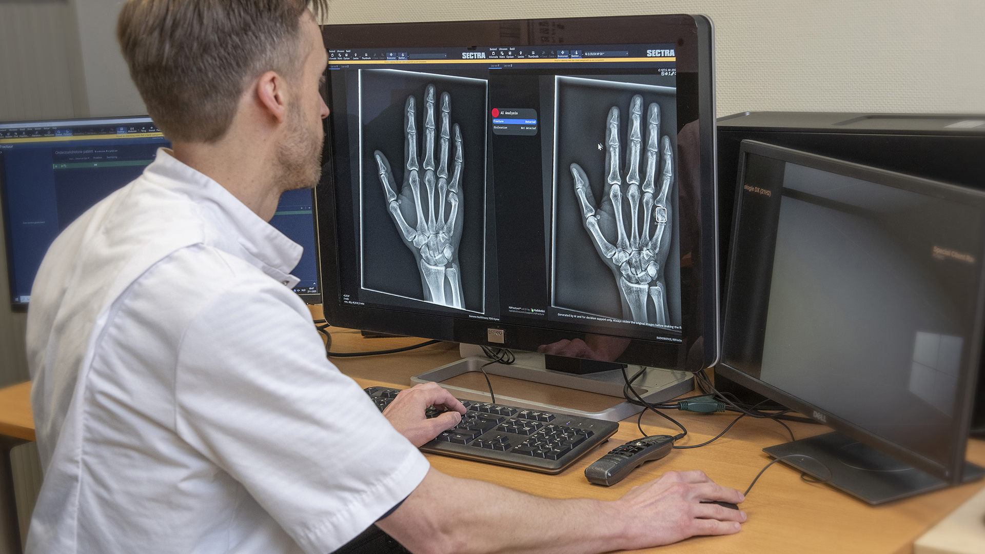 Foto: Tip voor wintersporters die een gipsvlucht ‘geboekt’ hebben