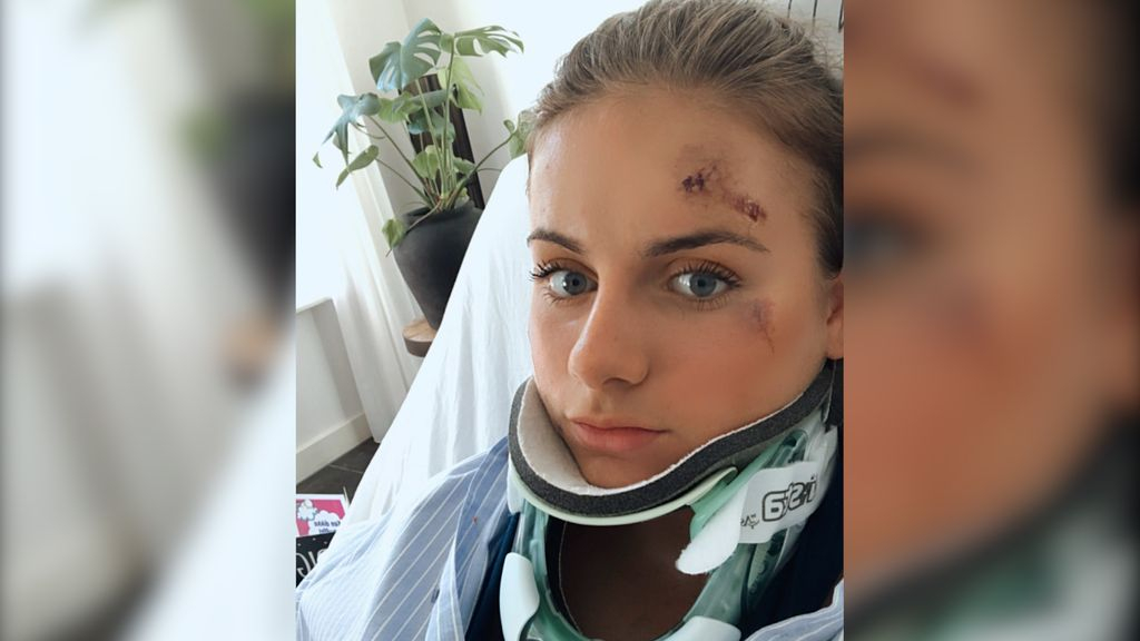 Foto: Floor waarschuwt hardlopers na ernstig ongeluk: 'Zet je muziek niet achterlijk hard'